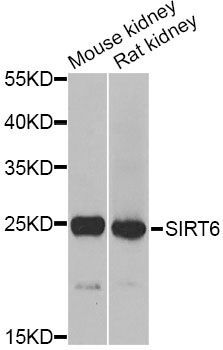 Western blot - MSRA Polyclonal Antibody (144-12464)