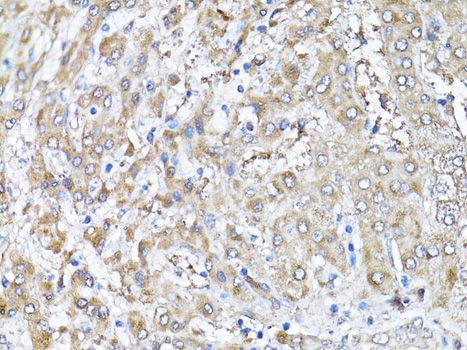 Immunohistochemistry - SNAI1 antibody (144-011794)