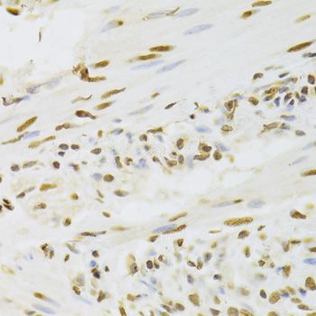 Immunohistochemistry - HNRNPD Polyclonal Antibody (144-01828)