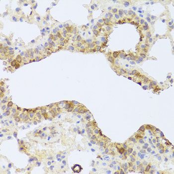 Immunohistochemistry - PDK3 antibody (144-08028)