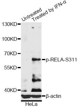 Western blot - Phospho-RELA-S311 pAb (144-50445)