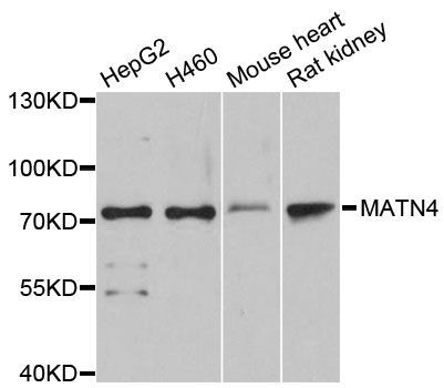 Western blot - MATN4 antibody (144-02761)