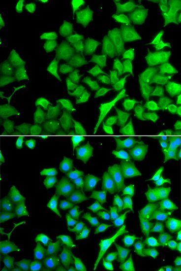 Immunofluorescence - NAA50 antibody (144-07387)