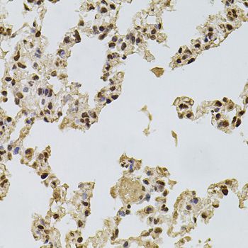Immunohistochemistry - FGF2 Polyclonal Antibody (144-00235)