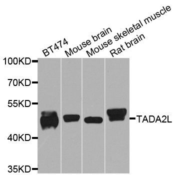 Western blot - TADA2A Polyclonal Antibody (144-08457)