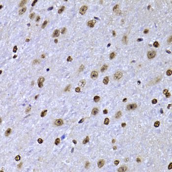 Immunohistochemistry - SOX5 Polyclonal Antibody (144-06985)