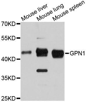 Western blot - GPN1 antibody (144-12167)