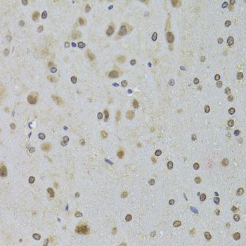 Immunohistochemistry - DDX1 Polyclonal Antibody (144-06575)