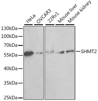 Western blot - SHMT2 Polyclonal Antibody (144-01215)
