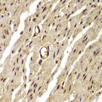 Immunohistochemistry - PSMB8 antibody (144-07340)