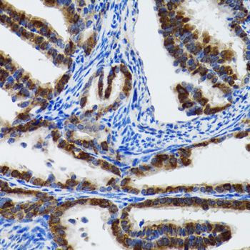 Immunohistochemistry - HSPH1 antibody (144-06622)