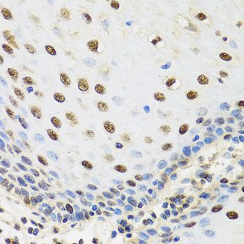 Immunohistochemistry - TAF15 antibody (144-08465)