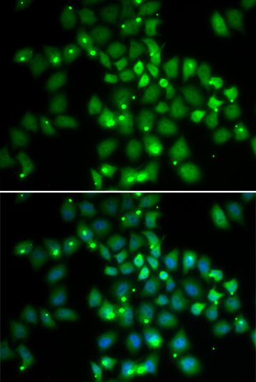 Immunofluorescence - PCGF6 Polyclonal Antibody (144-05760)