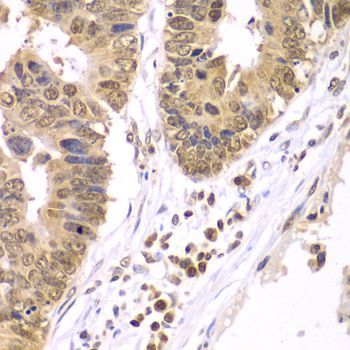 Immunohistochemistry - IKBKB antibody (144-02087)