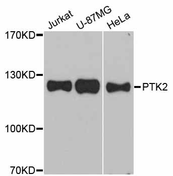 Western blot - PTK2 Polyclonal Antibody (144-60065)