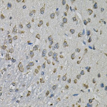 Immunohistochemistry - EIF3H Polyclonal Antibody (144-013378)