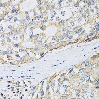 Immunohistochemistry - SLC3A2 antibody (144-05702)