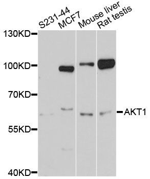 Western blot - AKT1 Polyclonal Antibody (144-011016)