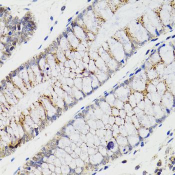 Immunohistochemistry - CHMP4B antibody (144-07402)