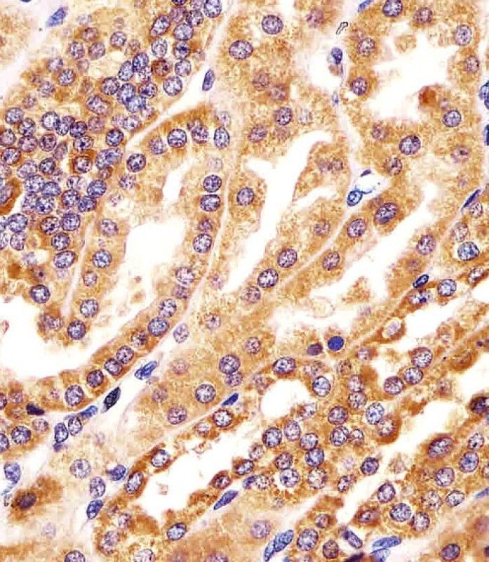 IHC-P