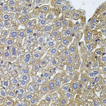 Immunohistochemistry - CETP antibody (144-01355)