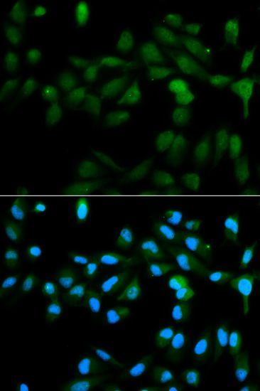 Immunofluorescence - CYP11A1 Polyclonal Antibody (144-01713)