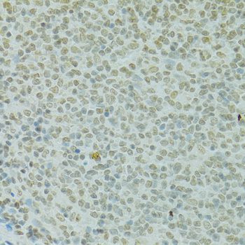 Immunohistochemistry - RCC1 Polyclonal Antibody (144-06350)