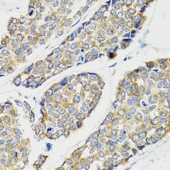 Immunohistochemistry - IKBKG Polyclonal Antibody (144-00917)