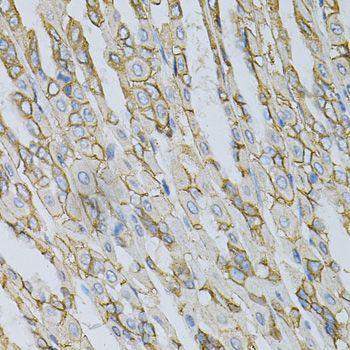 Immunohistochemistry - AP2B1 Antibody (144-01995)