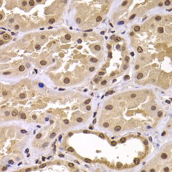 Immunohistochemistry - CSRP2BP antibody (144-07380)