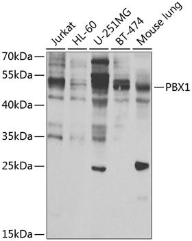 Western blot