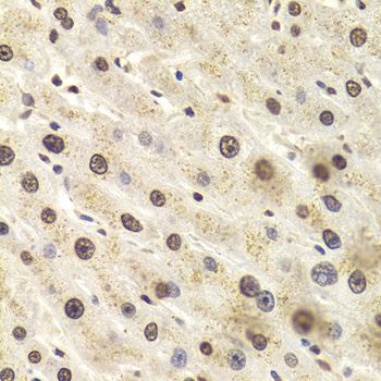Immunohistochemistry - HNRNPD Polyclonal Antibody (144-01828)