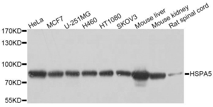 Western blot - HSPA5 Polyclonal Antibody (144-011366)