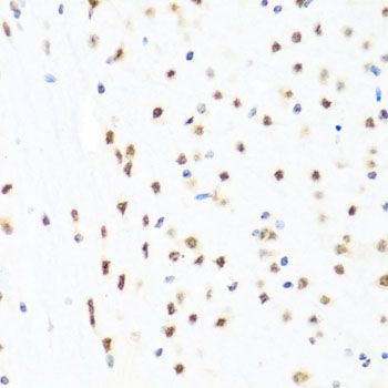 Immunohistochemistry - GATA2 Polyclonal Antibody (144-00677)