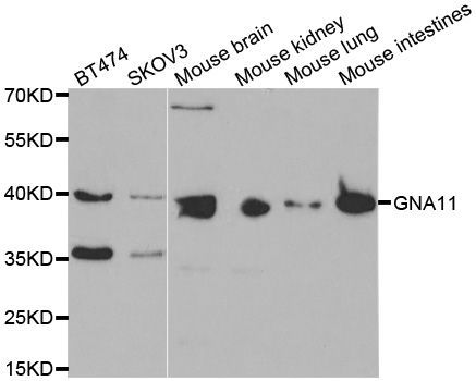Western blot - GNA11 antibody (144-02731)