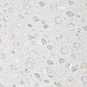 Immunohistochemistry - MAP1LC3B Polyclonal Antibody (144-11282)