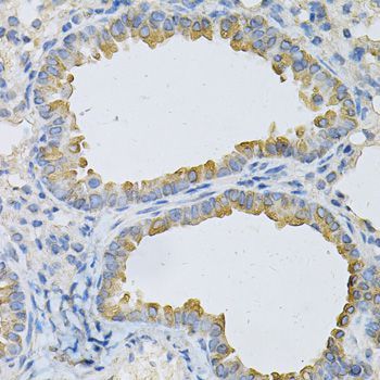 Immunohistochemistry - AP2B1 Antibody (144-01995)