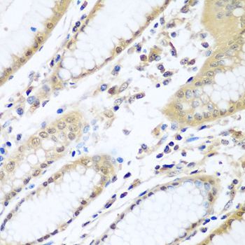 Immunohistochemistry - WDR48 Polyclonal Antibody (144-06854)