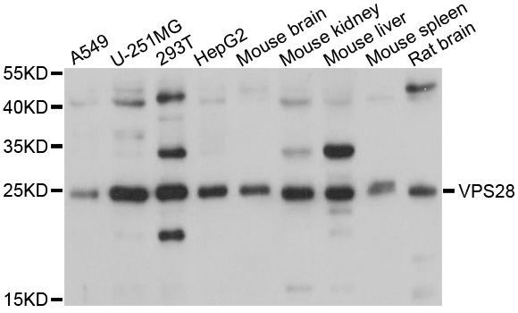 Western blot - VPS28 antibody (144-09104)