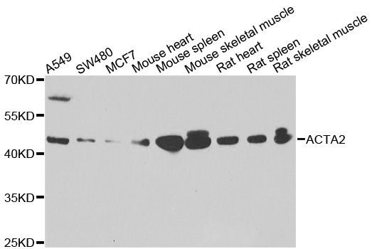 Western blot - ACTA2 Polyclonal Antibody (144-60050)
