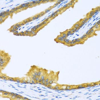 Immunohistochemistry - BTD antibody (144-06284)