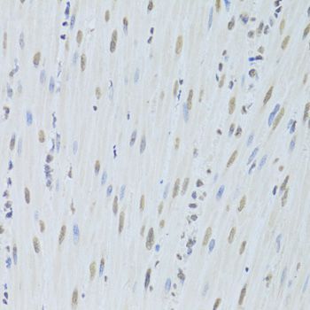 Immunohistochemistry - HNRNPK Antibody (144-01701)