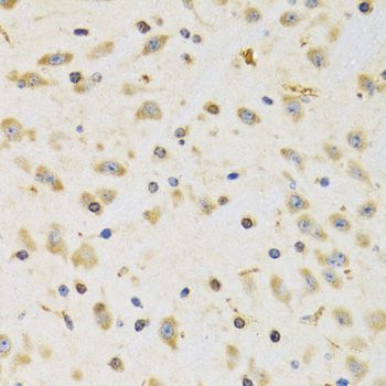 Immunohistochemistry - RPS12 antibody (144-05890)