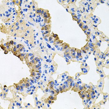 Immunohistochemistry - IGF1R Polyclonal Antibody (144-00243)