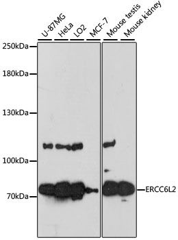 Western blot - ERCC6L2 antibody (144-60213)