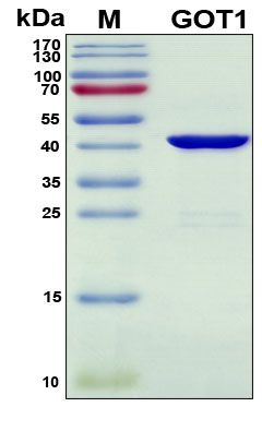 SDS-PAGE