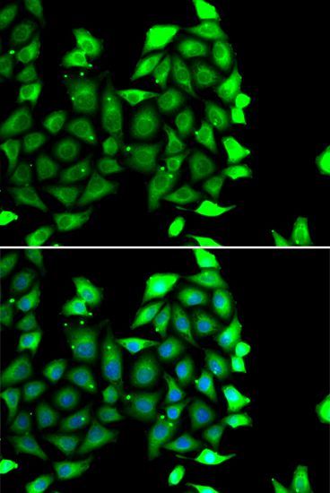 Immunofluorescence - IKZF3 antibody (144-07287)