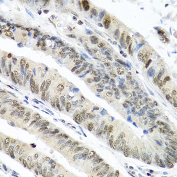 Immunohistochemistry - TIA1 antibody (144-12523)