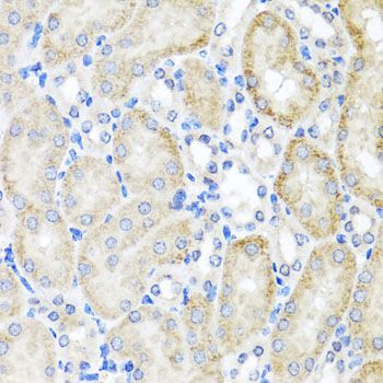 Immunohistochemistry - PSTPIP1 Polyclonal Antibody (144-07760)
