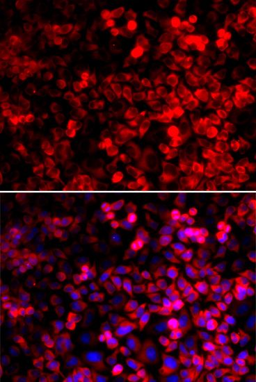 Immunofluorescence - QARS antibody (144-06960)